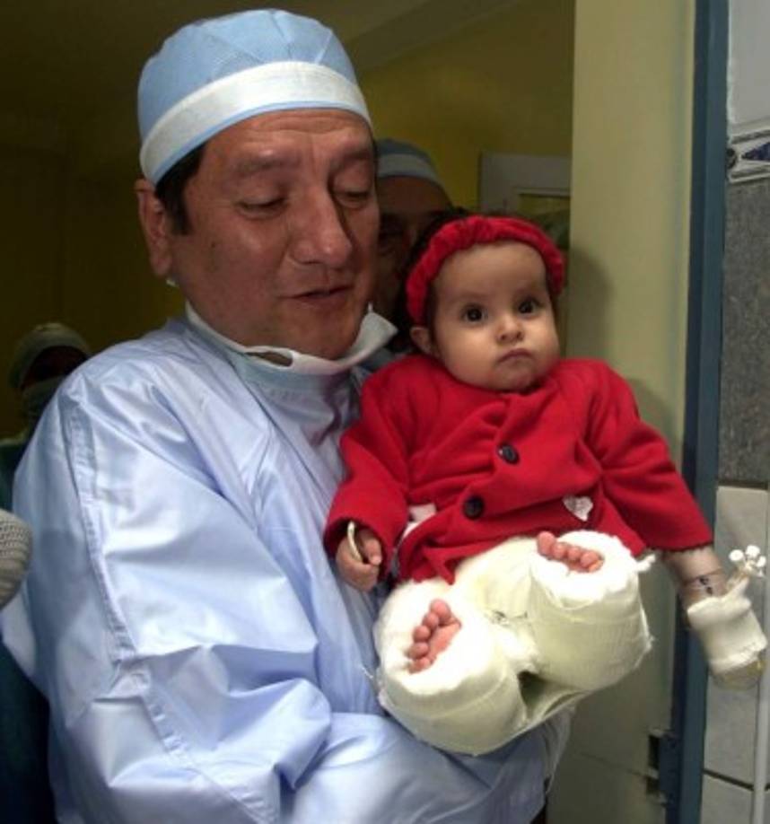 El médico recordó que solo una joven con un problema similar vivió hasta los 19 años, pero no logró movilizarse como lo hizo Milagros.<br/><br/>