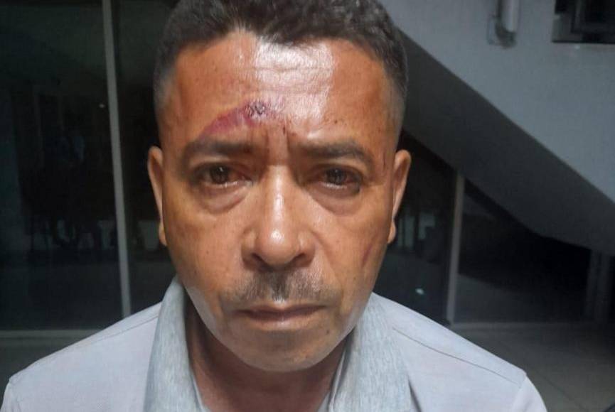 Esta estructura delincuencial organizada, operó al menos dos décadas, transgrediendo la ley, además como Modus operandi Mutilaban extremidades del cuerpo de sus víctimas.