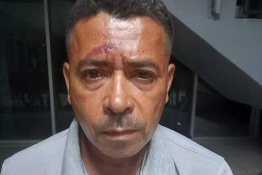 Capturan a “Estrellita” la “Mochadedos” en Santa Bárbara