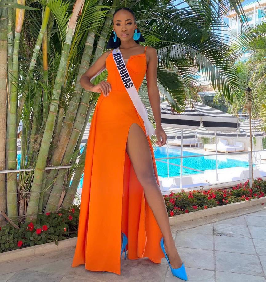 ¡Simplemente espectacular! Rose acertó al combinar este vestido color naranja con zapatos y aretes azul turquesa.