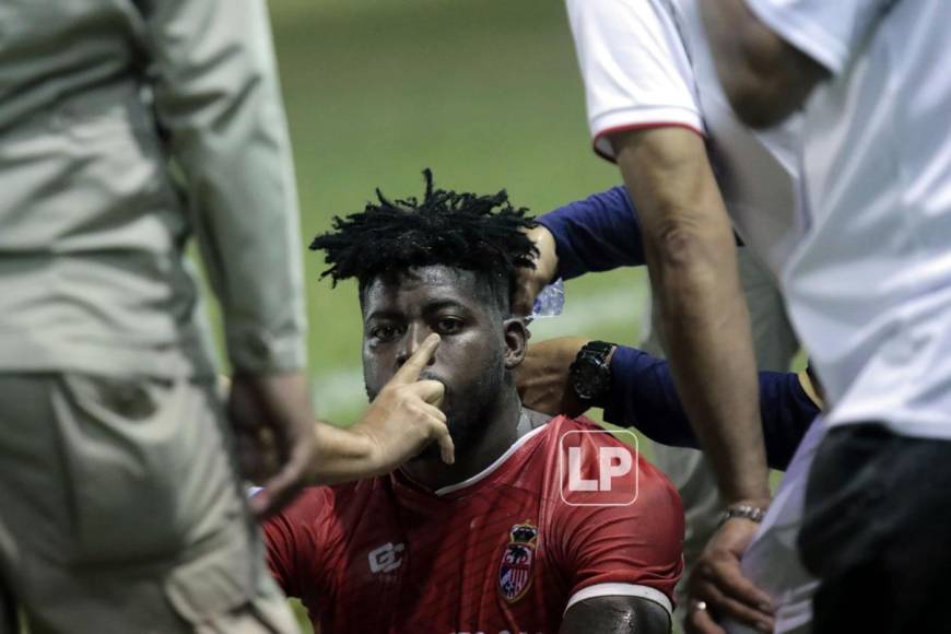 Darwin Diego cayó inerte tras el duro golpe y recibió asistencia médica. Tremendo susto se vivió en el estadio Humberto Micheletti.