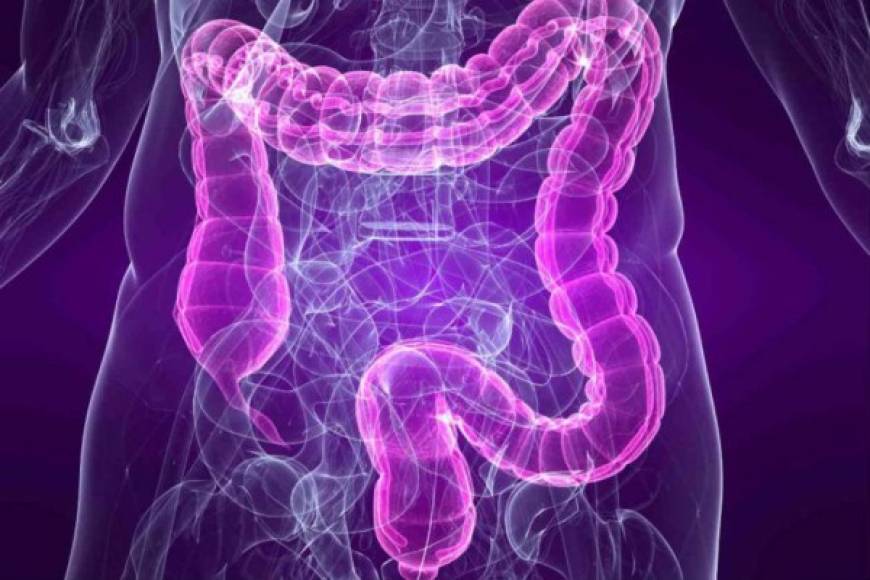 Muchas personas viven sin colon o sin una parte de él por cáncer u otras enfermedades. En algunos casos se hace una bolsa en el intestino delgado para sustituir al colon, o se tiene que utilizar una bolsa por fuera para recolectar las heces.