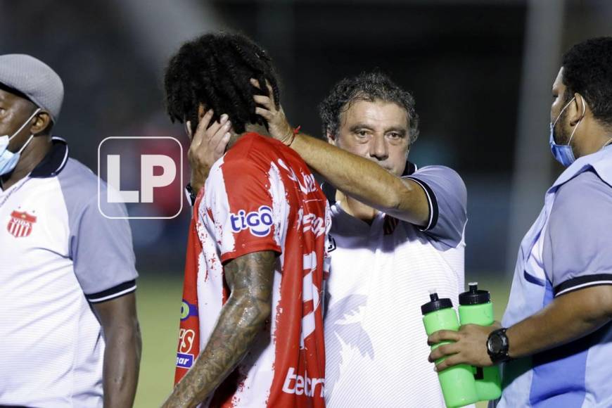 El entrenador portugués Fernando Mira, consolando a Henry Figueroa quien salió de cambio en el primer tiempo.