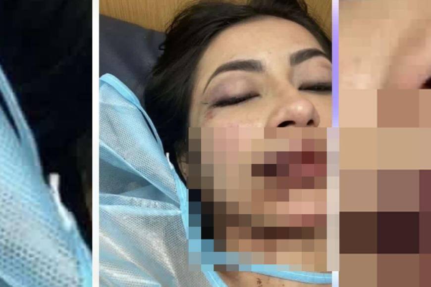 La joven Daniela Aldana fue agredida por su novio Isaac Emanuel Sandoval Ayala.