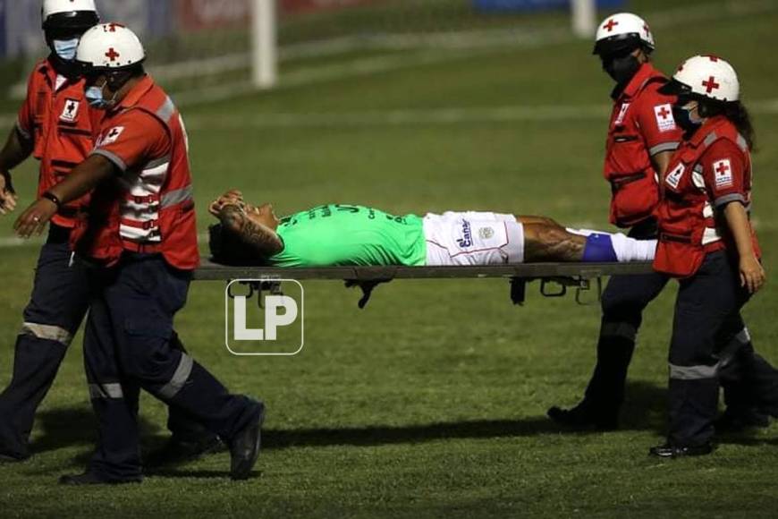Luis Garrido se fue en camilla lesionado tras llevarse un golpe en una falta que él cometió y por la que fue expulsado.