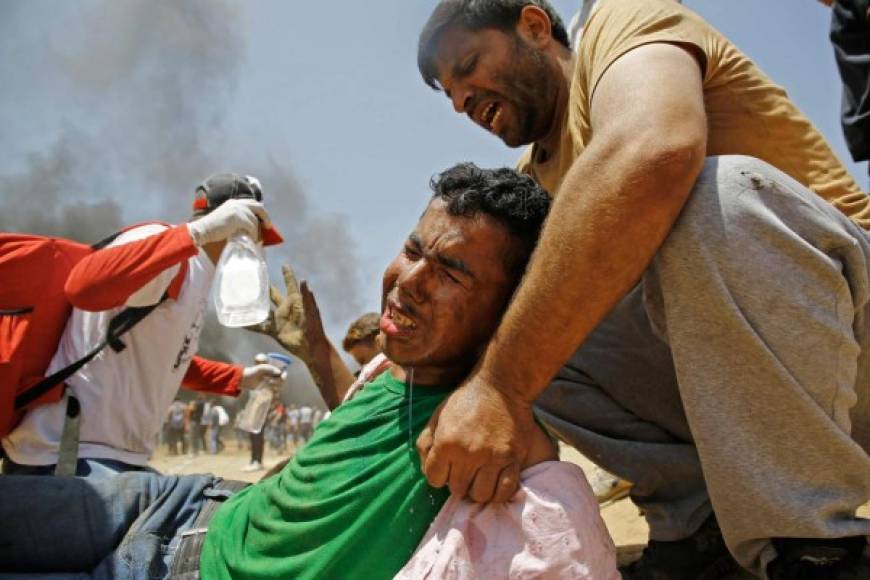 Al menos 2.400 palestinos resultaron heridos en las protestas de ayer y hoy, por disparos israelíes o por inhalar gas, según el ministerio.