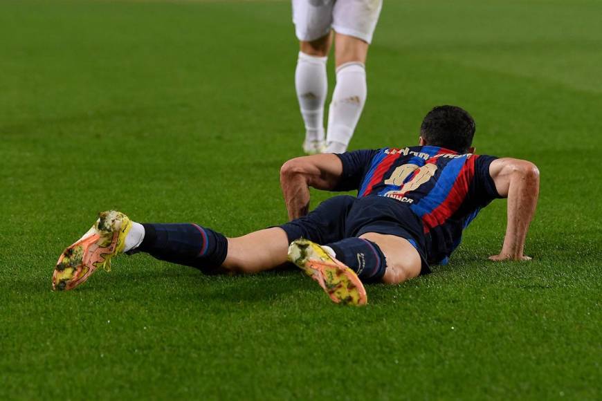 Robert Lewandowski no la pasó bien contra el Bayern Múnich.