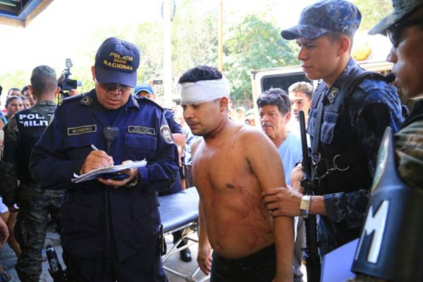 Un total de 33 reclusos heridos fueron atendidos en el hospital Mario Rivas de San Pedro Sula.