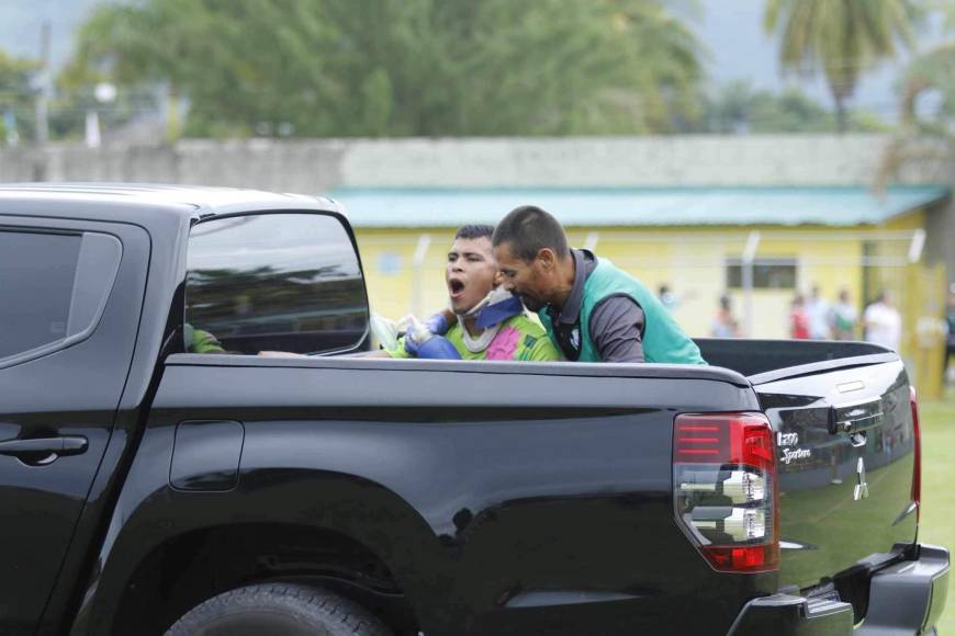 Emilson Figueroa se fue junto al médico del CD San Juan a bordo del vehículo que entró a la cancha.