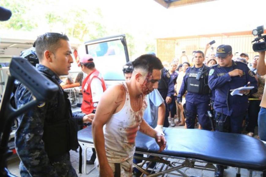 Un total de 33 reclusos heridos fueron atendidos en el hospital Mario Rivas de San Pedro Sula.