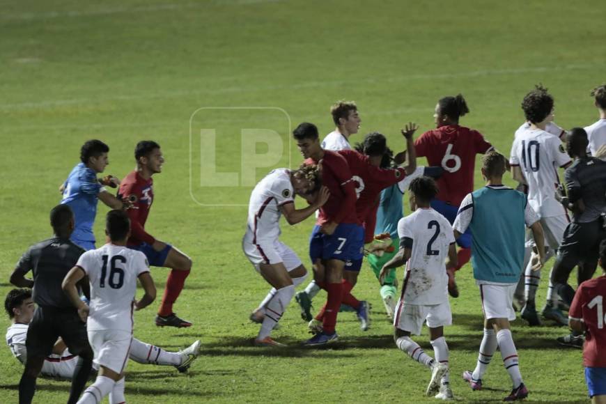 Fotos: La vergonzosa pelea entre jugadores de Costa Rica y Estados Unidos por el Premundial Sub-20 de Concacaf