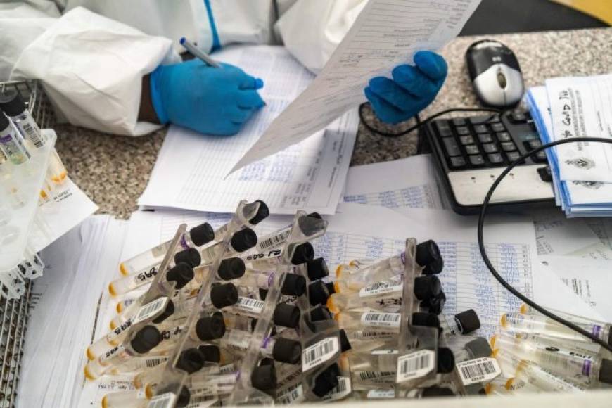 Los científicos de Oxford pretenden comparar sus resultados con los del laboratorio privado de Sinovac Biotech, con sede en Beijing, qué está se encuentra en fase uno y dos para una nueva vacuna contra el coronavirus.