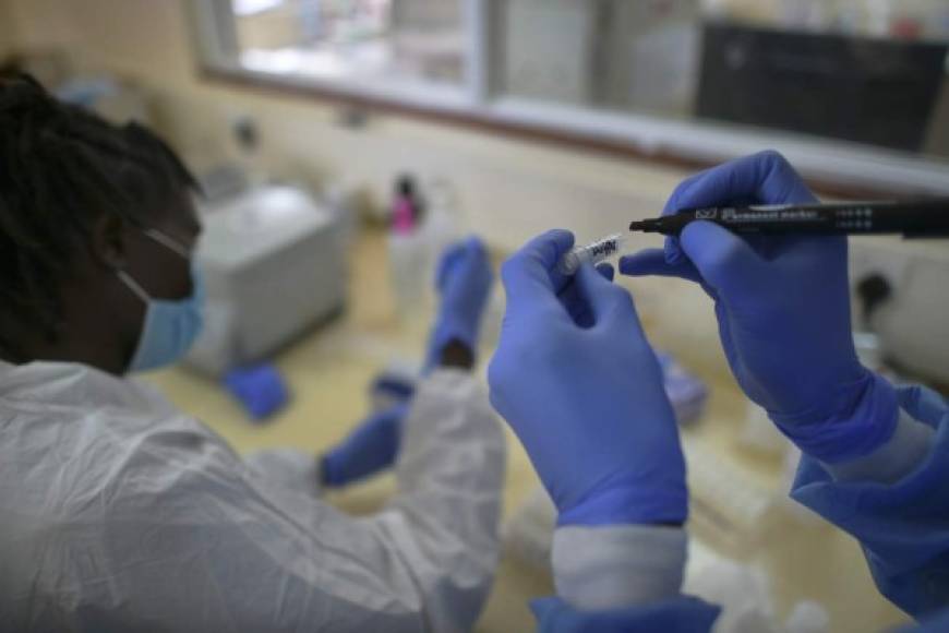 <br/>Los científicos del Advent-Irbm y del Instituto Jenner de la universidad de Oxford concluyeron que la vacuna contra el coronavirus en septiembre de 2020, luego<br/>de terminar las pruebas con los otros humanos voluntarios. <br/><br/>Foto ilustrativa.