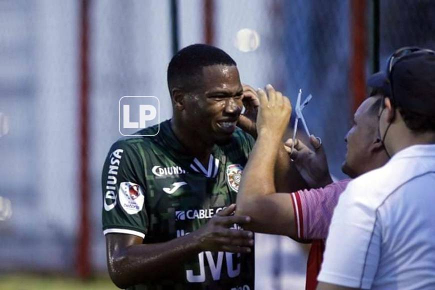 Parece a Santiago Córdoba le dolió la manera en la que le quitaron el arete. Después volvió al campo.