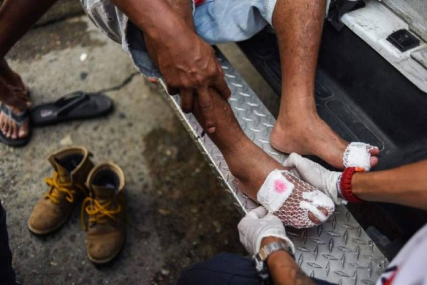 Voluntarios de la Cruz Roja mexicana atendieron a varios migrantes que tenían heridas en sus pies tras caminar durante horas por varios días con el fin de llegar a Estados Unidos.