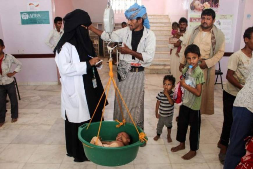 El gobierno yemení, apoyado por Arabia Saudita, combate los rebeldes hutíes, a los que apoya Irán, en una guerra que ha causado ya la muerte de 2,200 niños, según la Unicef.