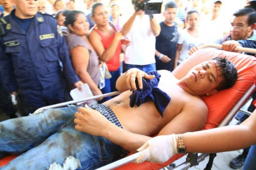 Los 33 reclusos que resultaron heridos fueron atendidos en el hospital Mario Rivas de San Pedro Sula.