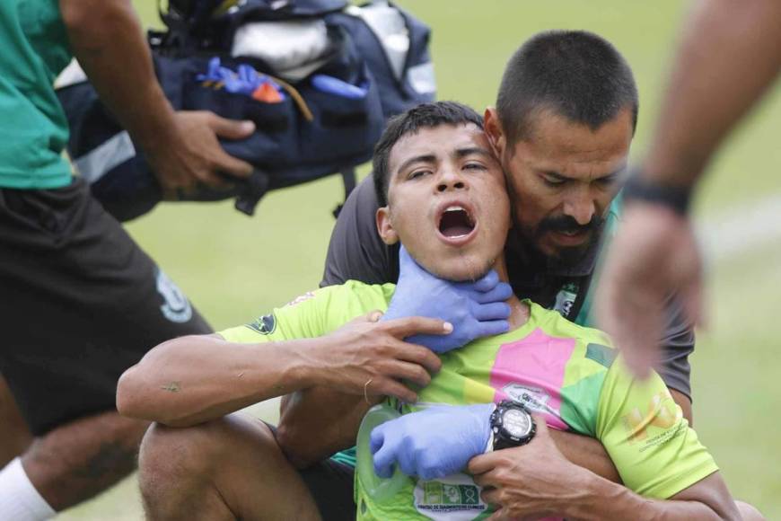 Emilson Figueroa saltó en la disputa de un balón, le ganó a su rival, que terminó impactando su cabeza en la garganta del jugador del CD San Juan.