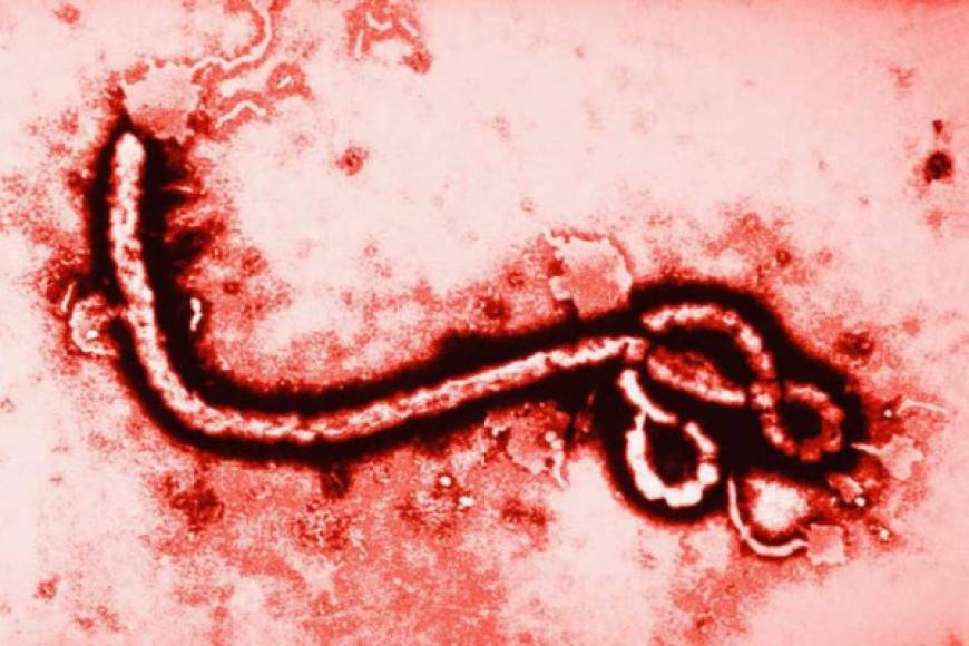 Virus del Ébola - El actual brote ha infectado a cerca de 2 mil personas, con una tasa de mortalidad que ronda el 90 por ciento, el epicentro de la epidemia se desarrolló en la capital de Guinea, Conakry, de donde se expandió a Liberia y Sierra Leona.