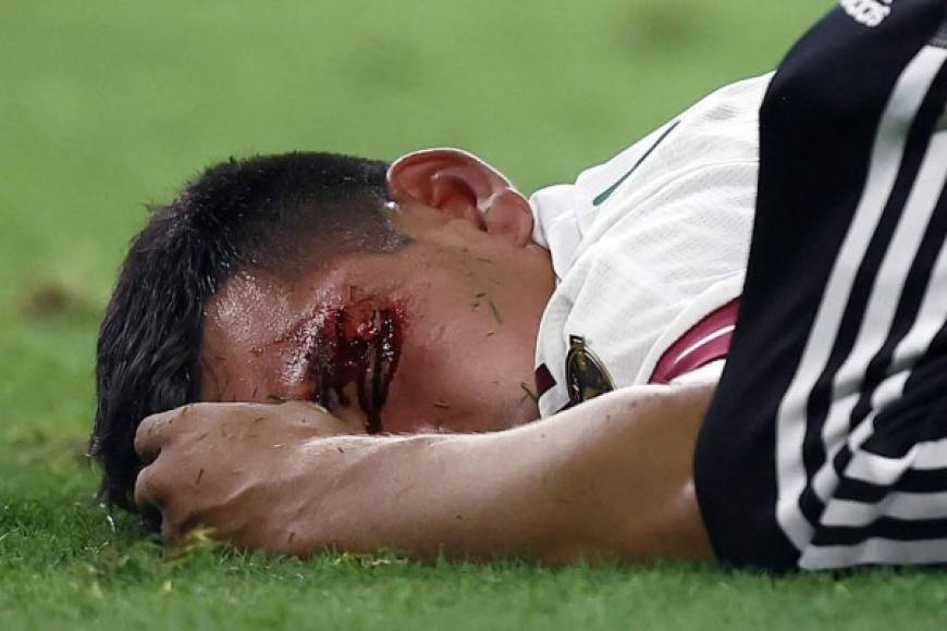 Escalofriante golpe del 'Chucky' Lozano: quedó noqueado con el rostro ensangrentado tras fuerte choque ante Trinidad y Tobago en Copa Oro