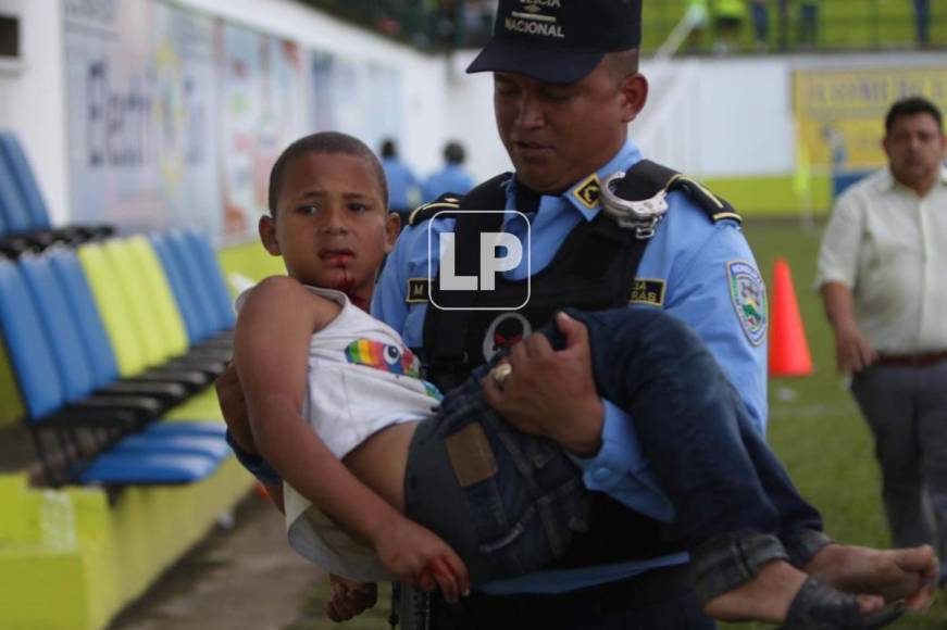 Un oficial de la Policía Nacional auxilió al niño que se cayó de las gradas del estadio Juan Ramón Brevé Vargas.