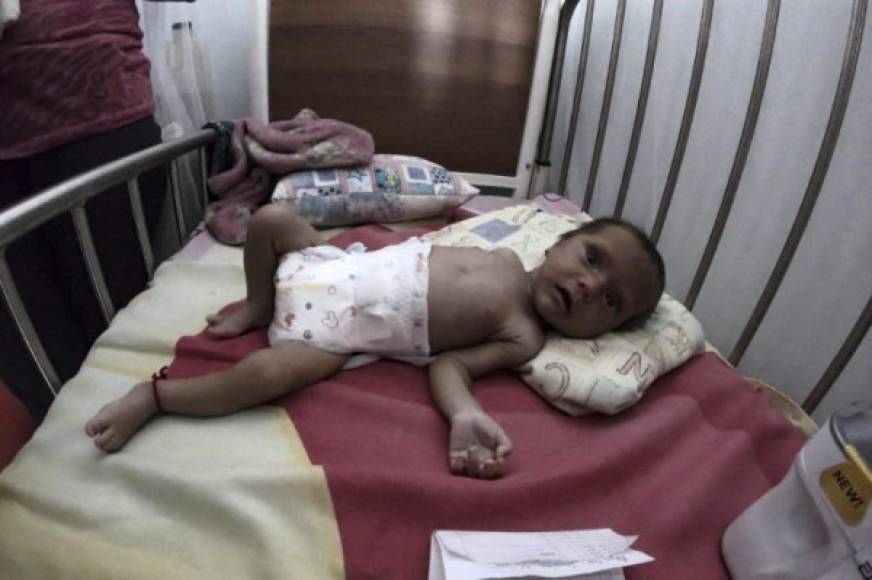 Este bebé ha permanecido en una cama de hosspital en Maracay, víctima de la desnutrición debido a la escasez de alimentos.