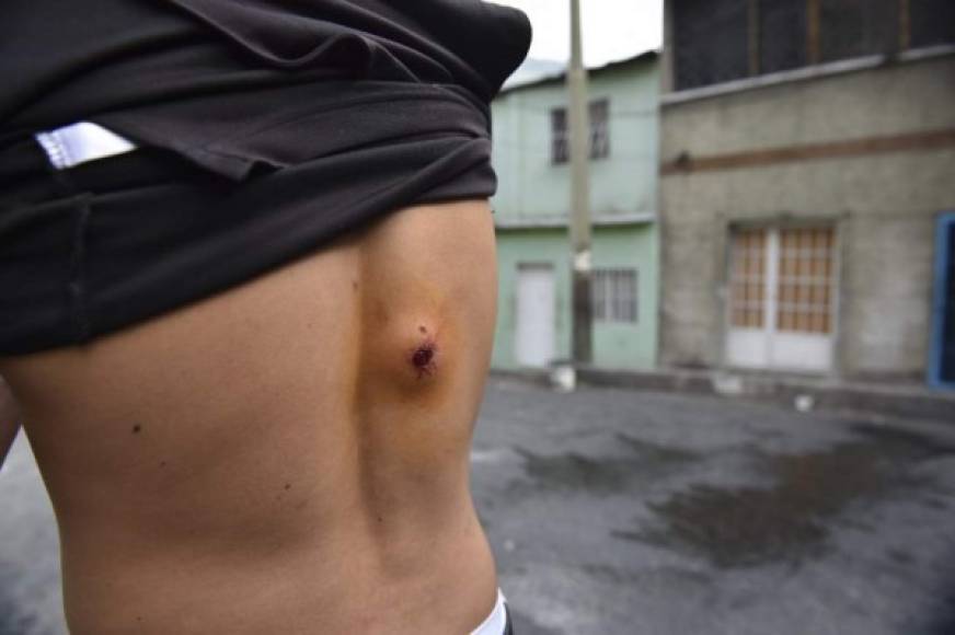 Estallido de violencia en Caracas tras alzamiento militar