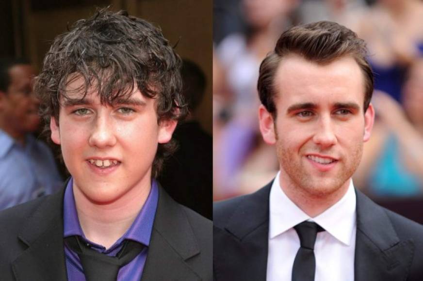 Matthew Lewis.<br/>Cuando era más joven, el actor lucía unos dientes bastantes separados y tal parece que eso no le agradaba mucho, pues optó por mejorarlos y presumir unos dientes blancos y parejos.Lewis es reconocido a nivel mundial por formar parte del mundo mágico de la saga de 'Harry Potter', claro que también cuenta con otros trabajos como 'One The Syndicate', serie de la BBC por la que recibió una nominación a los Premios de la Crítica Televisiva.