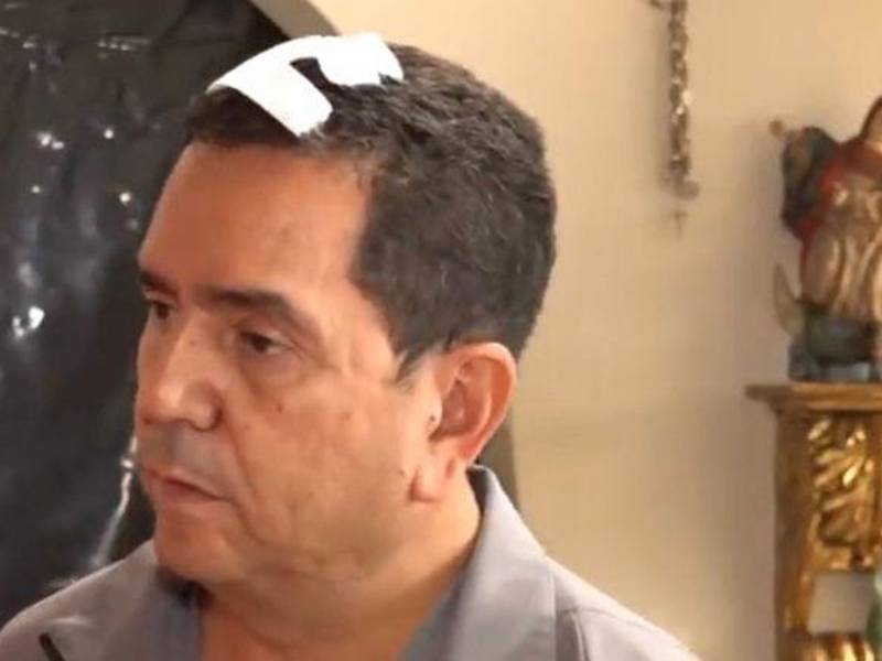 Antonio Rivera Callejas, diputado del Partido Nacional, resultó con una herida en su cabeza tras los disturbios en el Congreso Nacional de Honduras.