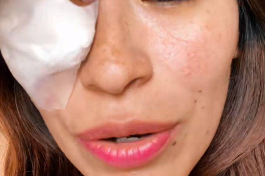 La fan de Karol G no perdió la visión del ojo, pero tendrá que traerlo cubierto por unos días para no exponerlo a la luz.