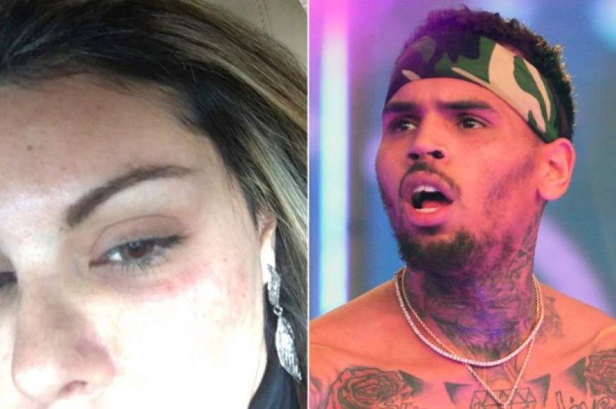 Gutiérrez fue noticia en todo el mundo cuando demandó al rapero Chris Brown por un supuesto altercado en una fiesta en Las Vegas.<br/><br/>Se dice que recibió alrededor de $70,000 dólares en compensación después de afirmar que un miembro del séquito de Brown la agredió en una fiesta de lujo organizada por el músico.<br/><br/>