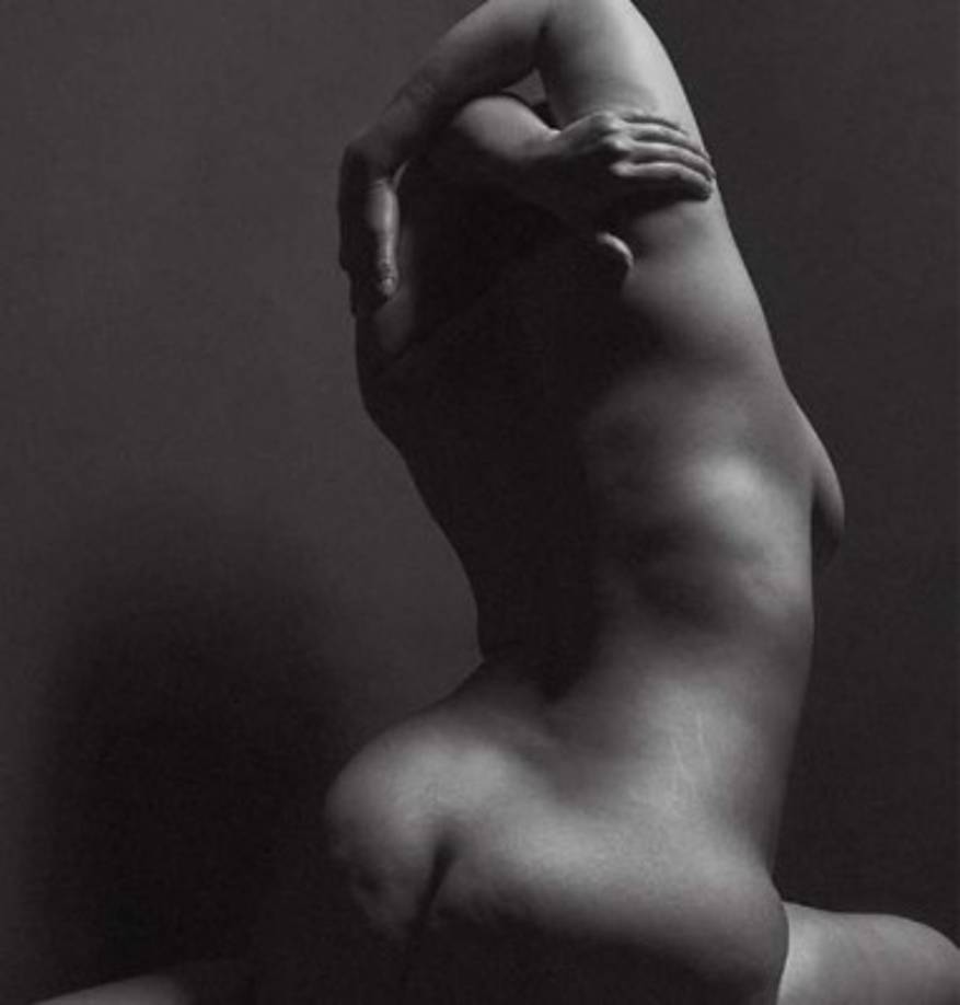 Habló sobre la inseguridad que le provocaba tener celulitis cuando era adolescente.<br/>