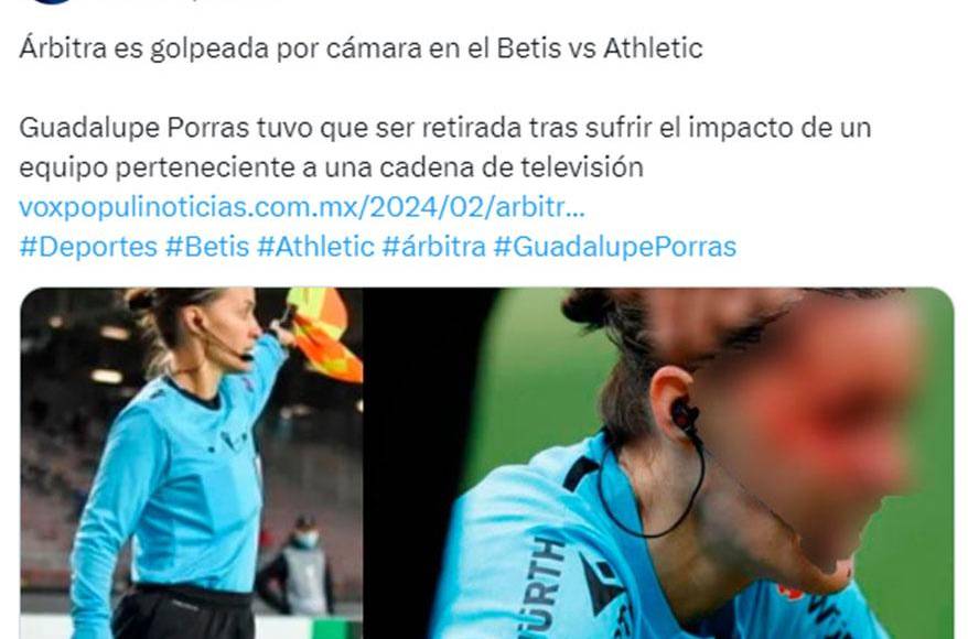 A pesar de los esfuerzos del personal médico presente en el estadio, Porras tuvo que ser retirada en camilla debido a una brecha en su rostro, dejando así su posición en la banda del Benito Villamarín vacante.