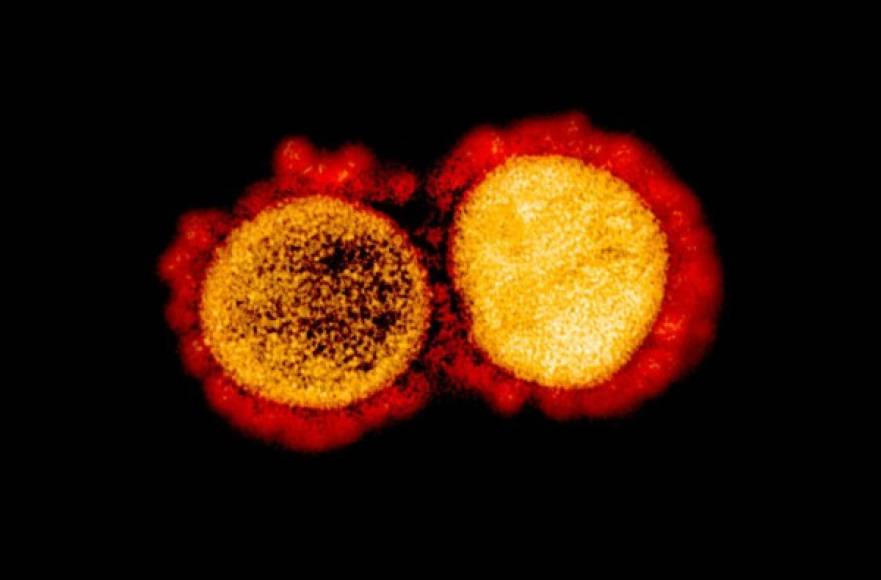 El coronavirus está compuesto por una cadena de ARN (ácido ribonucleico), cubierto de lípido y unos 'ganchos' de proteínas que le dan el nombre, ya que parece una corona.