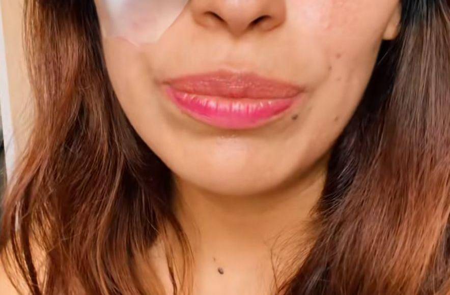 “Al terminar toda la presentación soltaron varios pirotécnicos que obviamente se fueron para arriba, todo estaba muy lindo, todo muy bonito, yo estaba a unos metros de la pasarela que tenía el escenario, (de pronto) siento que algo me entra al ojo, traté de no desesperarme hasta que sentí una punta”, describió la fan