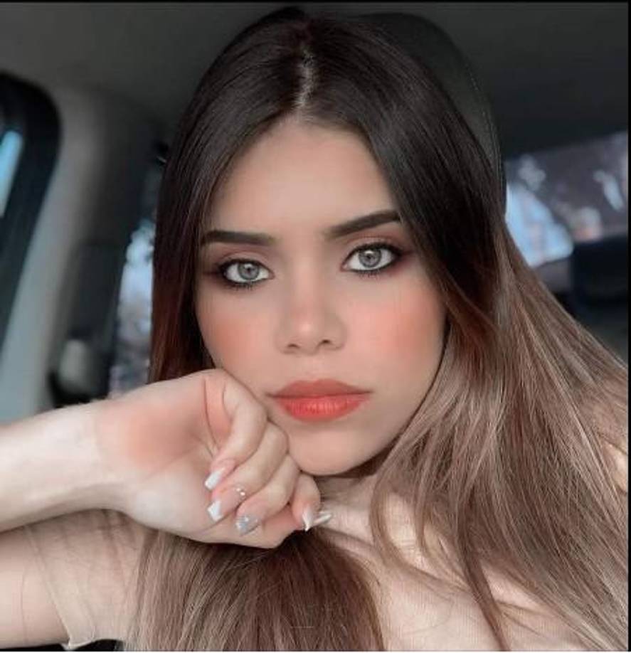 Sus familiares, desesperados por cubrir los gastos médicos decidieron abrir espacio en GoFundMe, donde lograron recaudar más de 4 mil dólares.