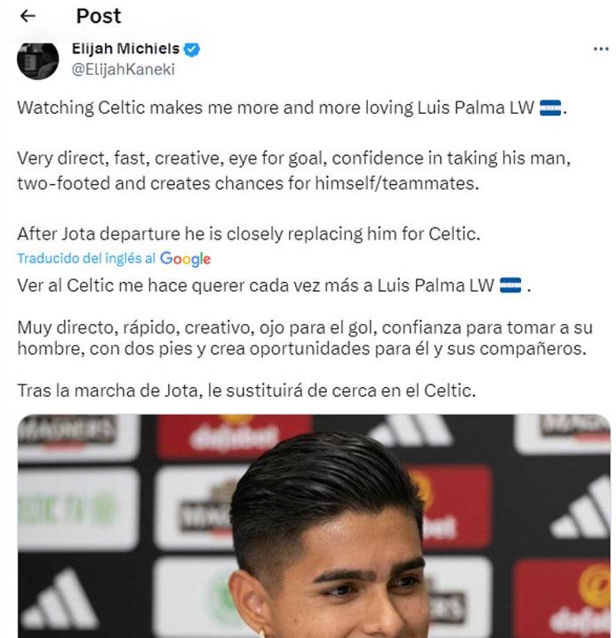 Luis Palma ha recibido elogios a nivel mundial por su gran rendimiento con la camiseta del Celtic. 