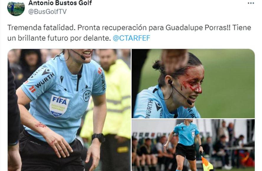 La jueza de línea, quien había validado el tanto del argentino y se dirigía hacia el centro del campo para continuar con el encuentro, sufrió un impacto que derivó en una lesión facial