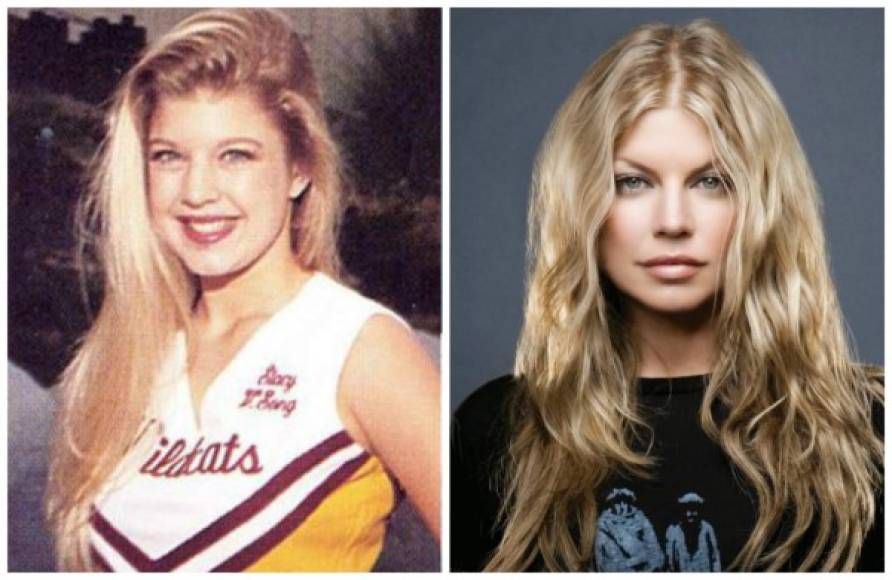 Antes de que Fergie fuera conocida como tal, la estrella se realizó una cirugía en el rostro.