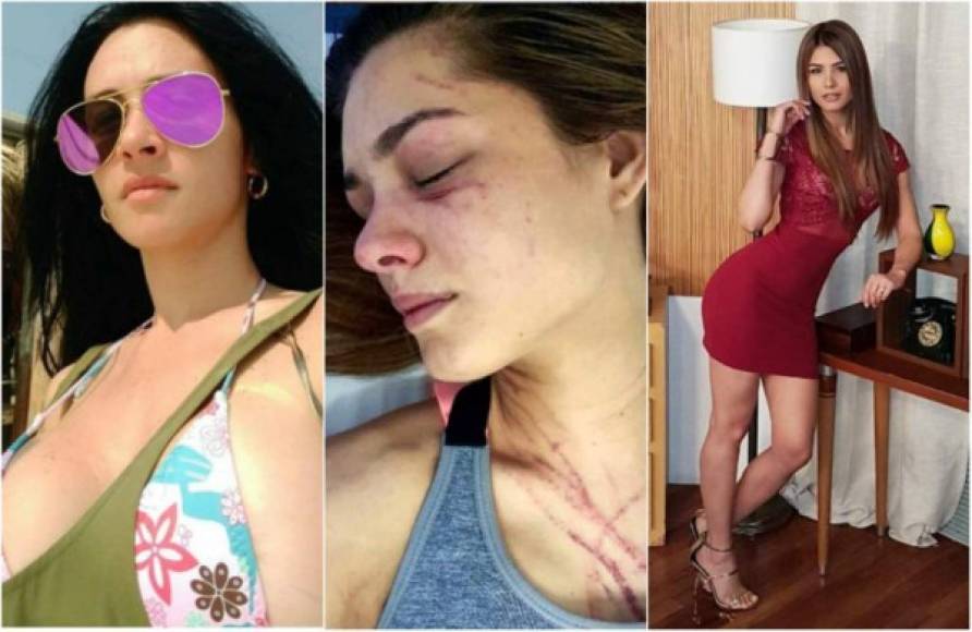 Recientemente la Diosa Canales atacó a mordidas a una conductora de televisión de su país.
