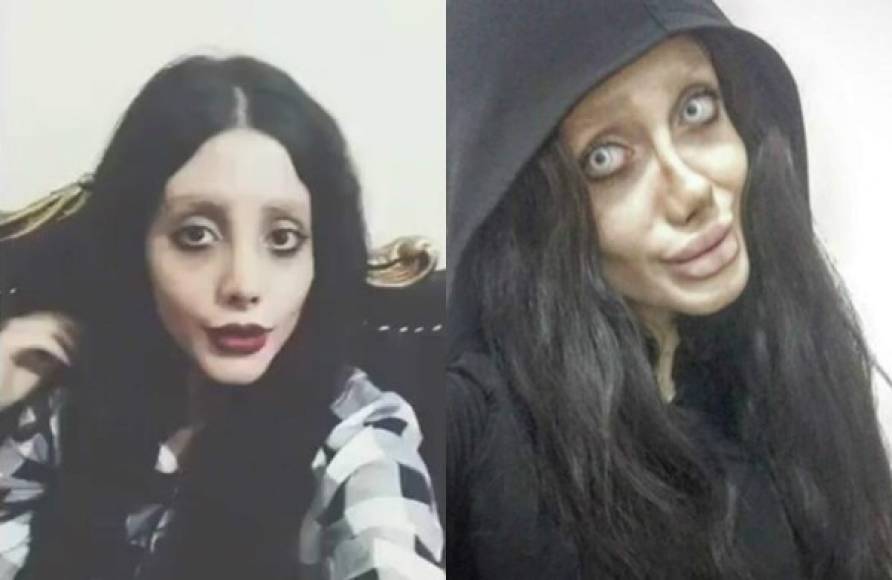 Se sospechaba que la joven usaba photoshop y prótesis para lograr ese aspecto 'zombie' tan polémico y que tantos seguidores le ha generado en sus redes sociales.<br/>