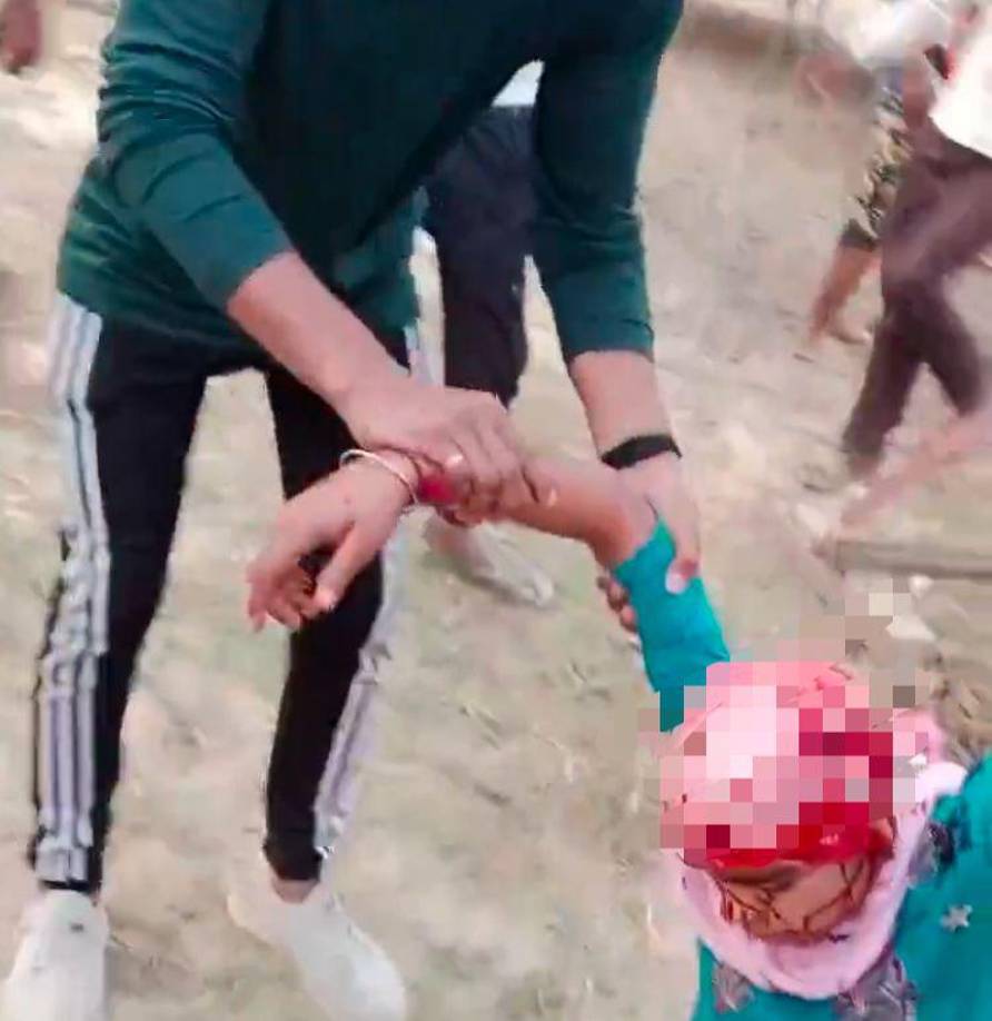 La niña se desmayó ante la intensa hemorragia.