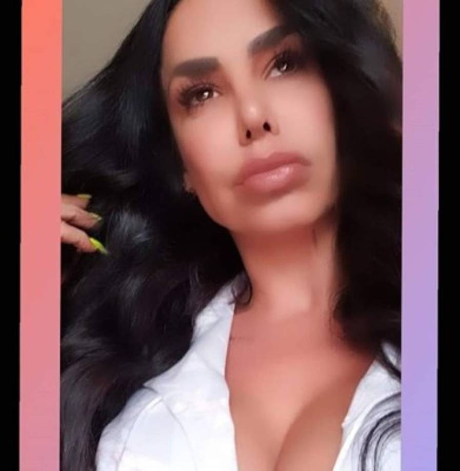 Es impresionante cómo ha cambiado su rostro con el aumento de tamaño de sus labios y retoques en el resto del rostro.