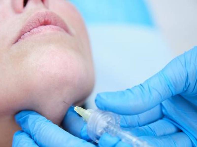 La carboxiterapia consiste en la aplicación de dióxido de carbono medicinal en la piel, lo que mejora la circulación y oxigenación de los tejidos,