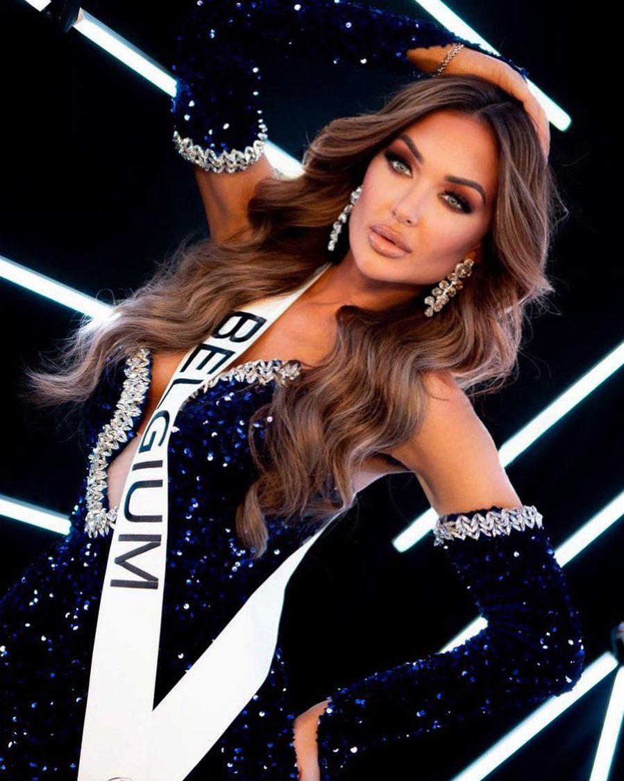 Miss Bélgica se recupera después del accidente