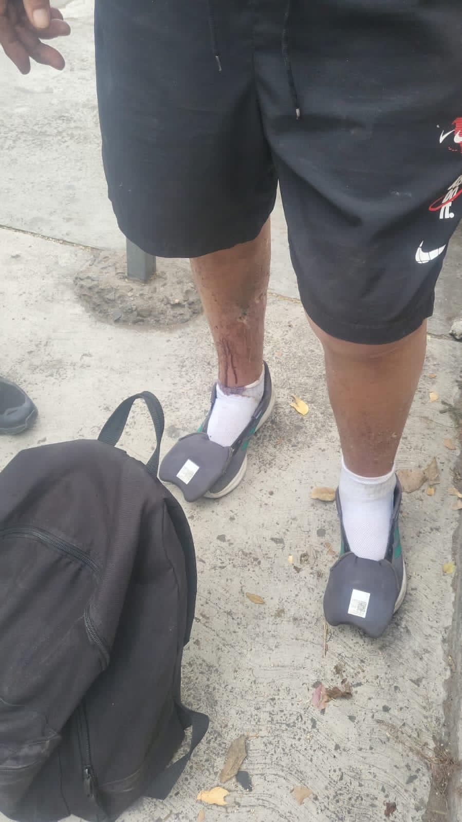 Roger Beard, el veterano de guerra de EE.UU. rescatado en SPS