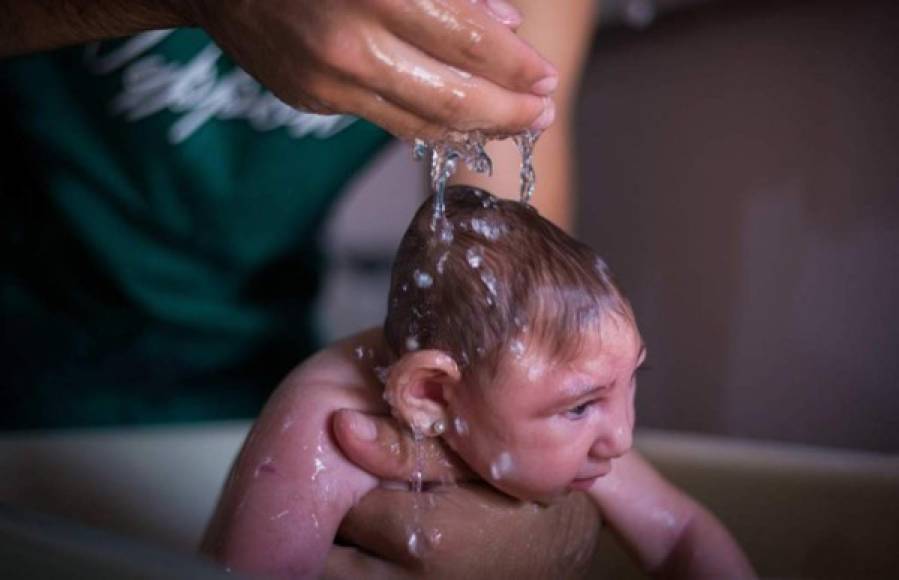 Alarma por el zika: nacen los primeros niños con microcefalia. Mujeres embarazadas infectadas por el virus de Zika (a finales de 2014) dieron a luz en julio de 2015 los primeros bebés con microcefalia relacionada con la enfermedad. <br/>“En total son ocho niños con microcefalia, seis del departamento de Choluteca, cinco nacieron esta semana”, dijo Yolani Batres, ministra de Salud, a finales de julio. <br/>