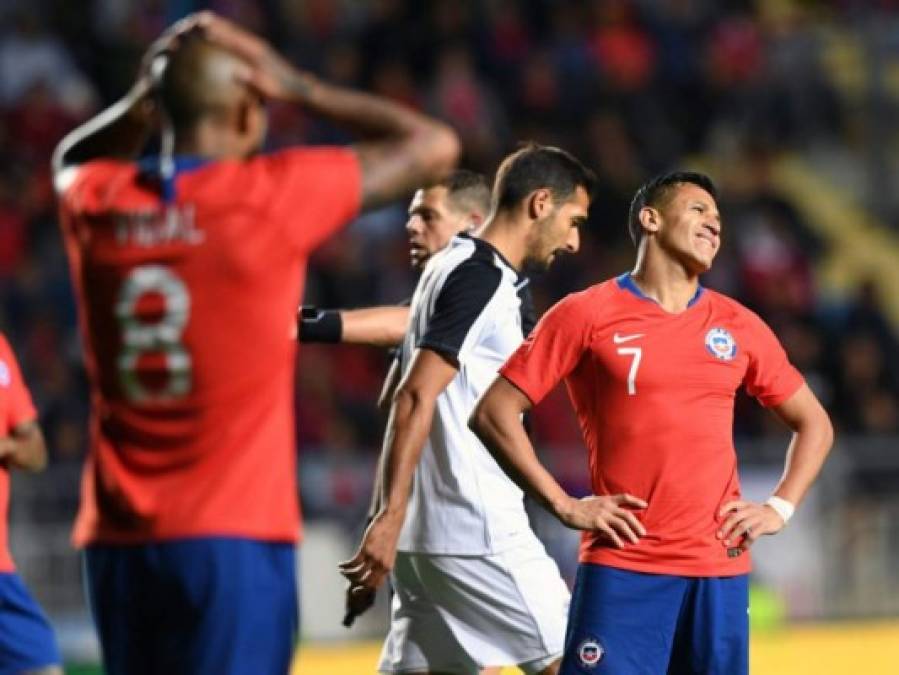 La selección de Chile fue un desastre ante Costa Rica el pasado viernes y hoy deberán de reponerse para enfrentarse a Honduras. El combinado chileno se medirá a la H este martes a las 6:15pm, horario hondureño.