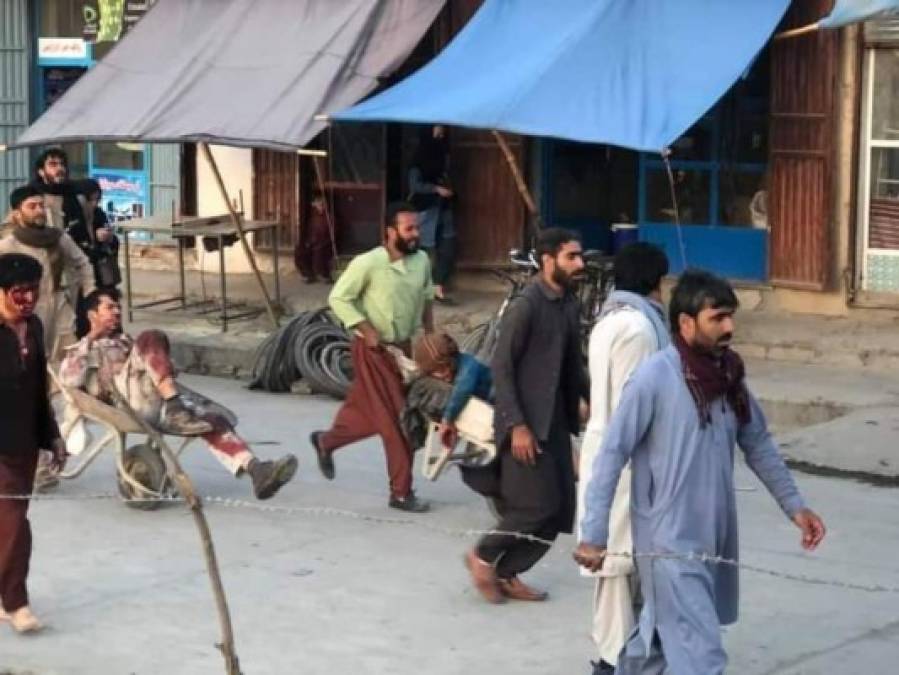 Un 'ataque complejo' el jueves en el aeropuerto de Kabul, donde se llevaba a cabo una operación masiva de evacuación de personas tras la toma del poder por los talibanes, causó varias víctimas estadounidenses y civiles, dijo el Pentágono.