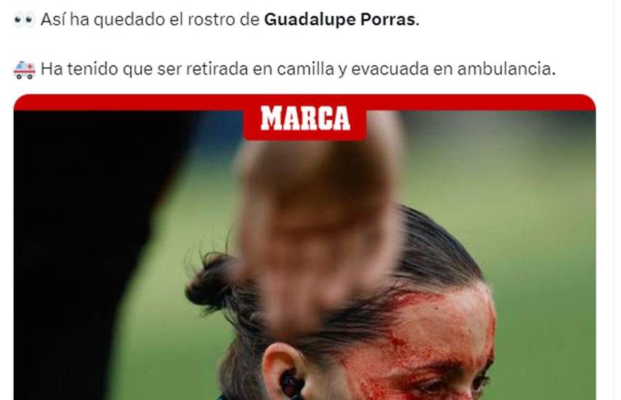 La asistente, que seguía esa jugada que acabó en gol, chocó con la cámara y, después de unos minutos de asistencia sobre el campo, se marchó del terreno de juego y la sustituyó el cuarto árbitro.